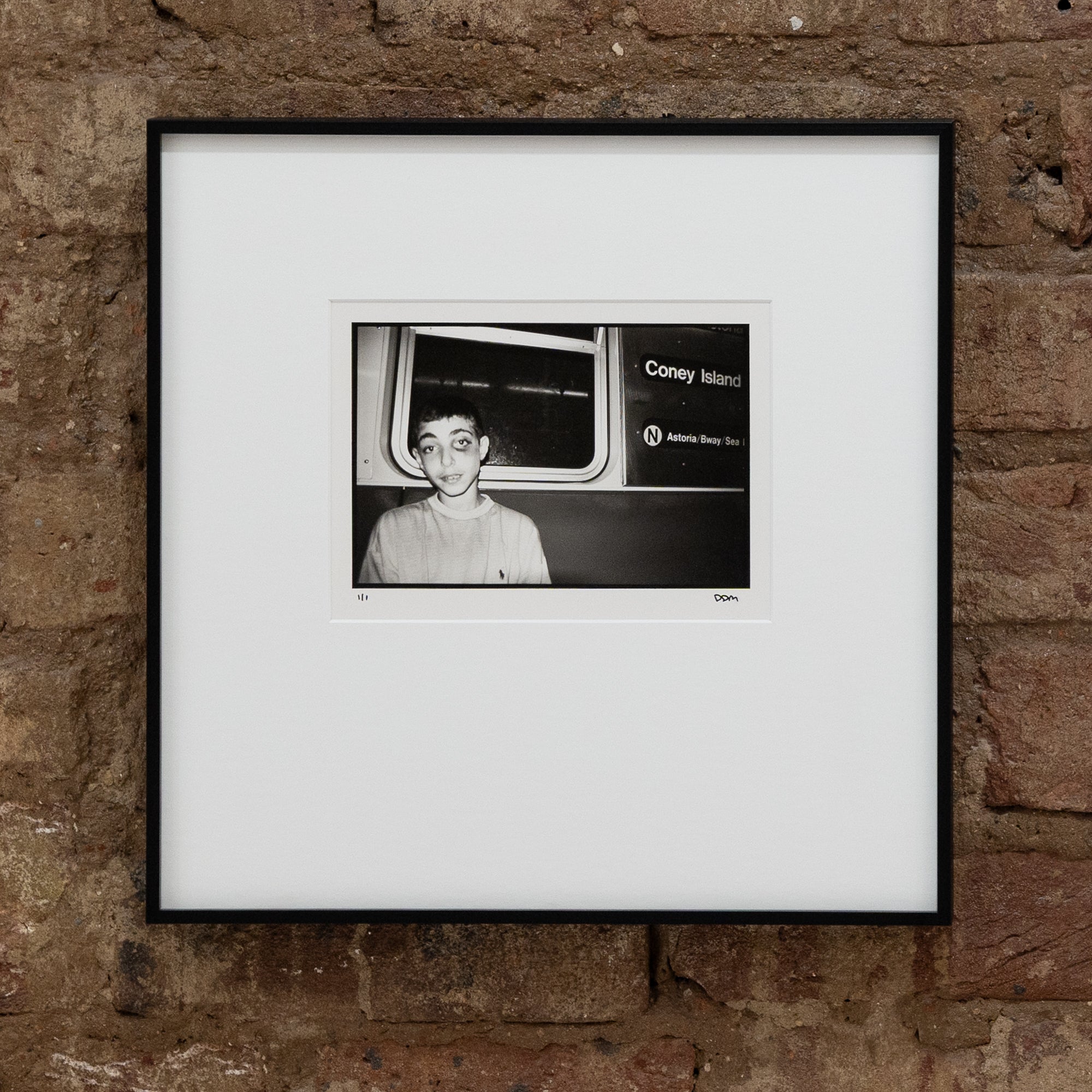 D. David Morin | Boy With A Black Eye on the N (New York City, 1992)