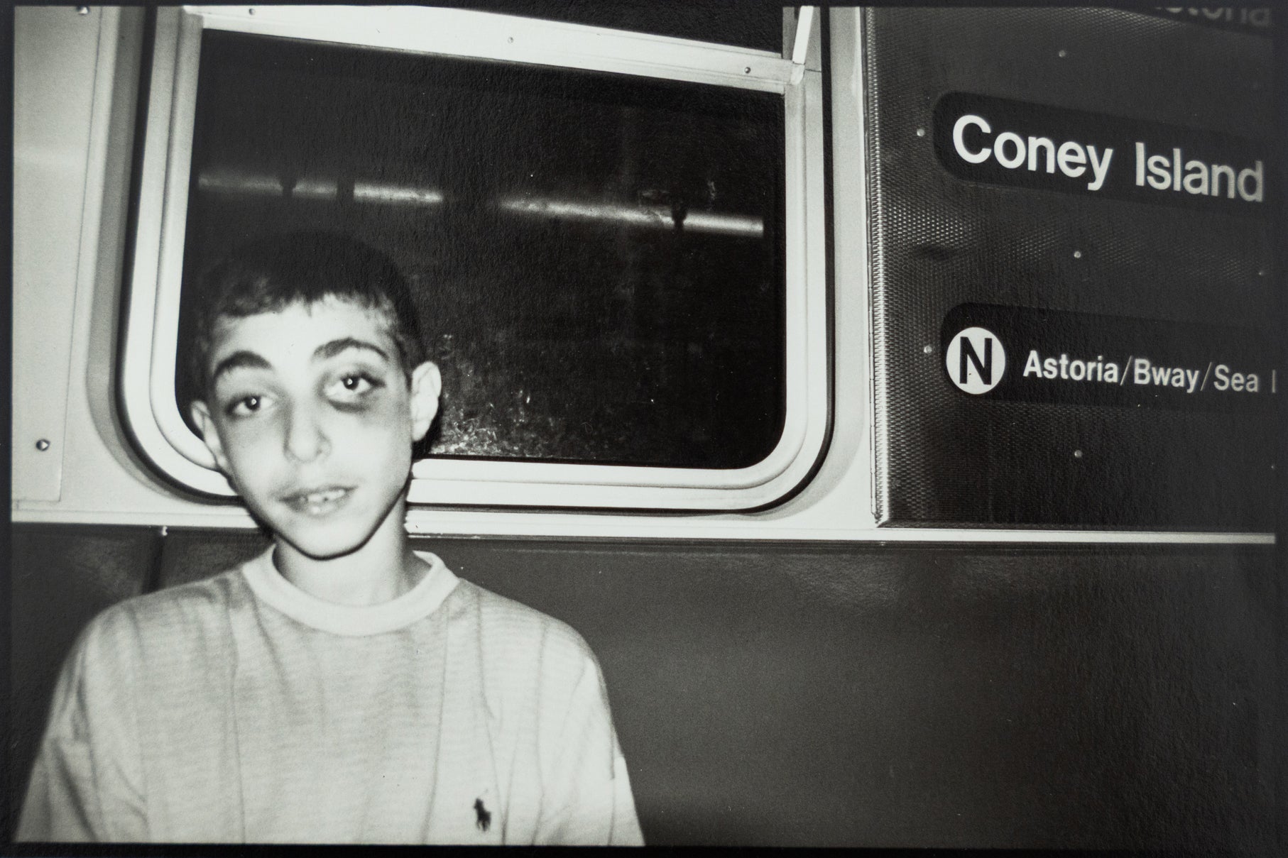 D. David Morin | Boy With A Black Eye on the N (New York City, 1992)